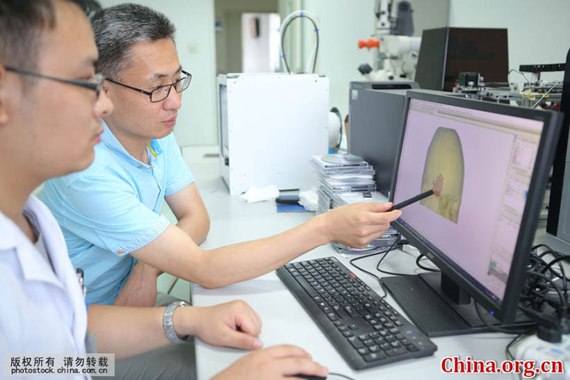 Cirurgia cerebral com tecnologia de impressão 3D é realizada em Shandong