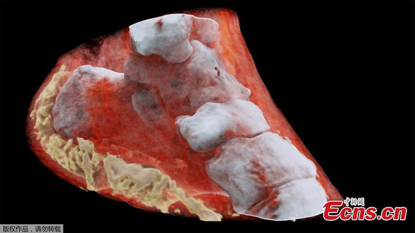 Cientistas neozelandeses realizam primeiro raio x a cores num ser humano